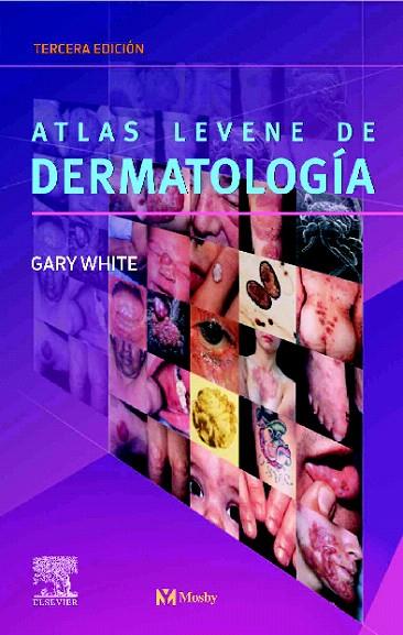 ATLAS LEVENE DE DERMATOLOGÍA | 9788481747652