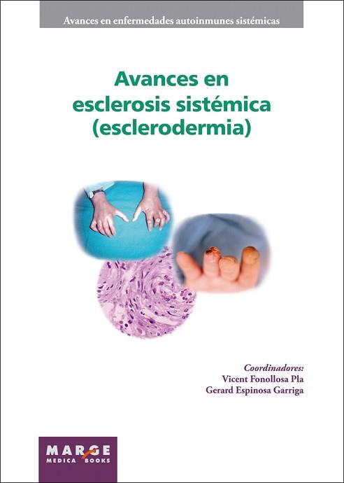 AVANCES EN ESCLEROSIS SISTÉMICA | 9788415004219 | FONOLLOSA PLA, VICENT / ESPINOSA GARRIGA, GERARD