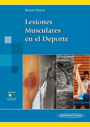 LESIONES MUSCULARES EN EL DEPORTE | 9788498357035 | BALIUS MATAS, RAMÓN | Llibreria L'Illa - Llibreria Online de Mollet - Comprar llibres online